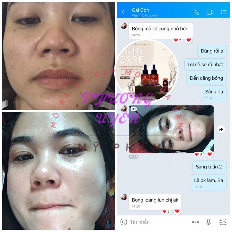 Serum Nano Hyaluronic Acid  -15ml ⚡CHÍNH HÃNG⚡ Kiềm Dầu Se khít lỗ chân lông Giữ nước Cấp nước Cấp ẩm làn da