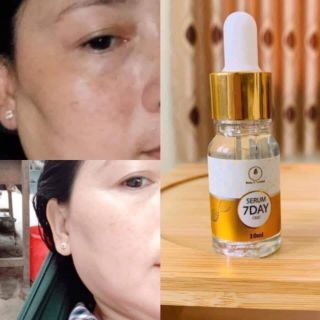 [ Hàng Chuẩn Cty ] Serum 7 Day Olic 10ml
