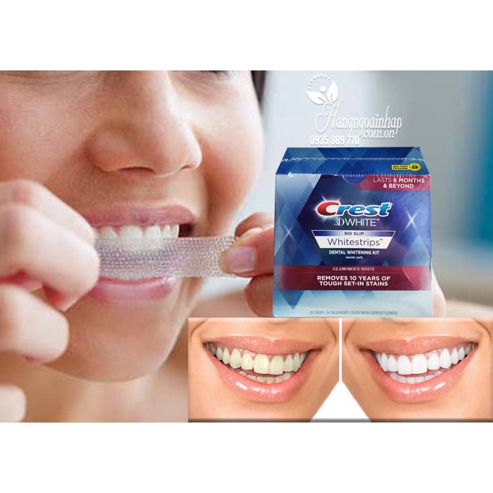 Liệu trình làm trắng sáng răng 3d crest - oralB  [ 14 và 21 miếng ]