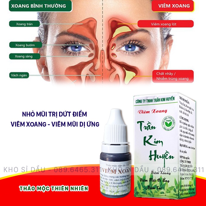 Viêm Xoang, Viêm Mũi Dị ứng, Viêm Tai giữa, Nước Nhỏ Mũi Viêm Xoang, Viêm mũi dị ứng Trần Kim Huyền, 10ml - Hàng ch