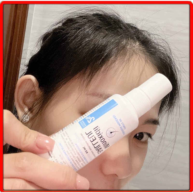 Mọc Tóc Nhanh Chóng - An Toàn. Lọ Xịt Minoxidil Bailleul 2% - Nhập khẩu Pháp. Giảm Rụng Tóc Và Kích Thích Mọc Tóc