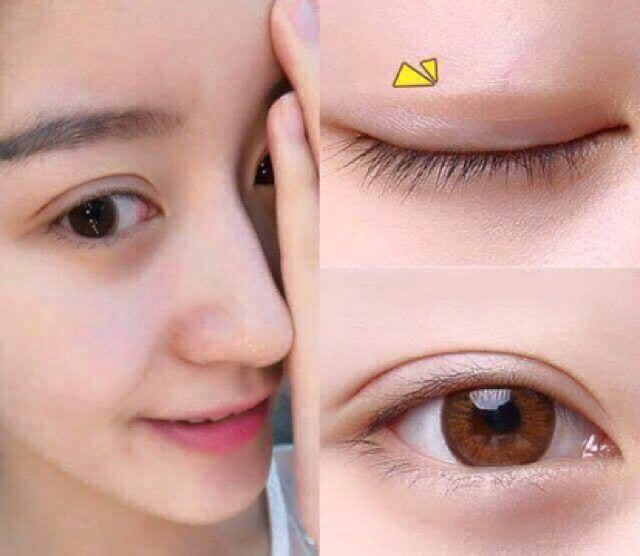 Miếng Dán Mí Lưới Keli Allergy Double Eyelid Stickers