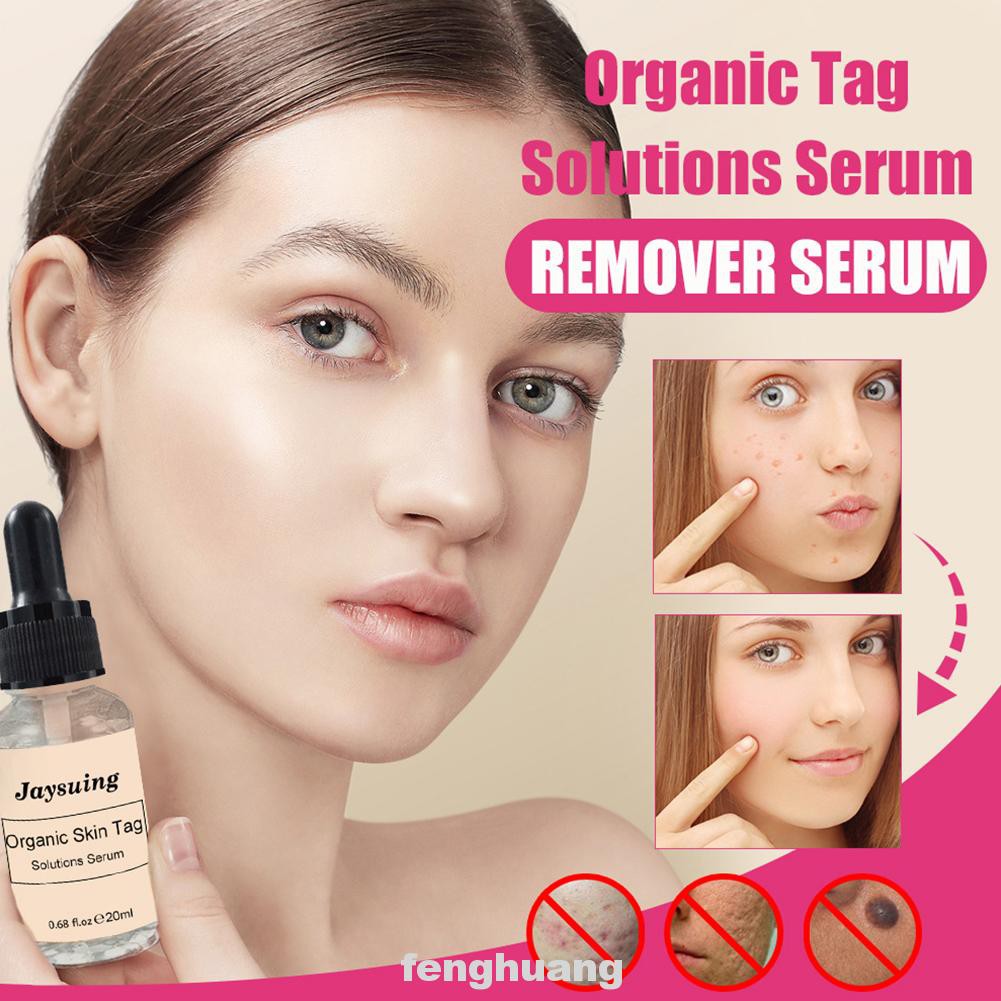 (Hàng Mới Về) Serum Trị Mụn Cóc Không Đau 20ml Tiện Dụng