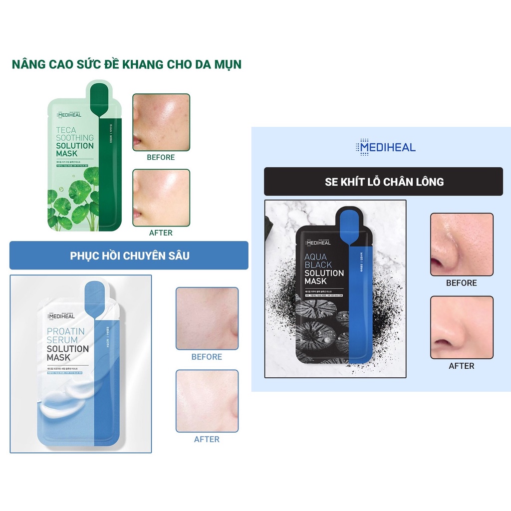 Hộp 10 Mặt nạ giấy cấp ẩm, dưỡng trắng, làm dịu da và cung cấp dưỡng chất cho da Mediheal Mask EX 25ml x 10