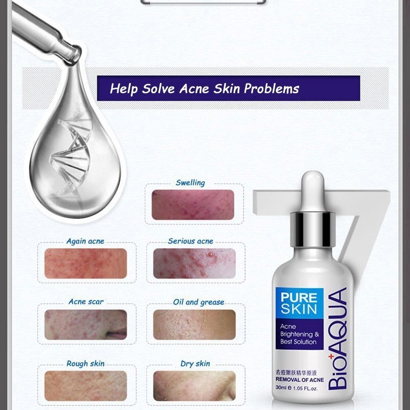 [Hàng mới về] Tinh chất Hỗ Trợ Giảm mụn BIOAQUA chất lượng cao | BigBuy360 - bigbuy360.vn