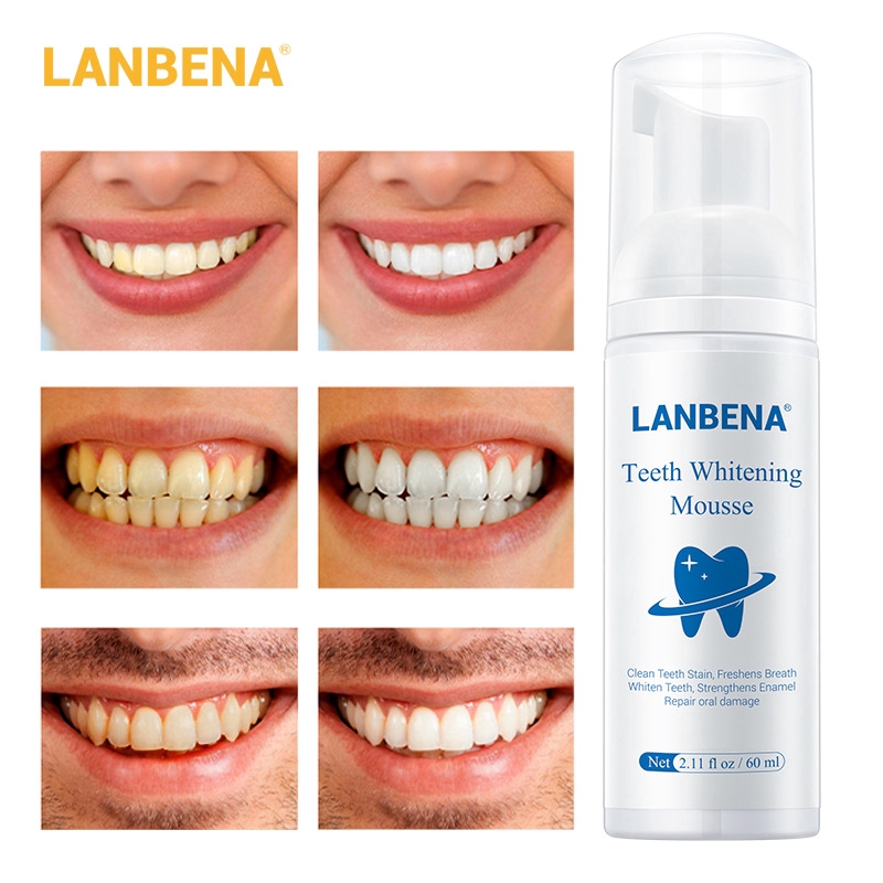 LANBENA teeth bright blue Beinuo Bai Jie yellow teeth stains teeth to tooth mousse 60ml dental calculus same paragraph Little Red Book