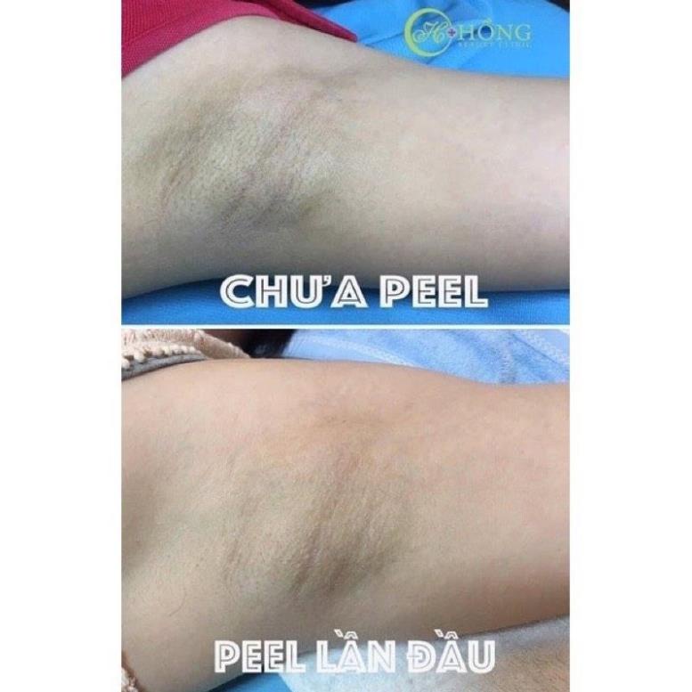 Peel ti,nách, bikini TCA USA