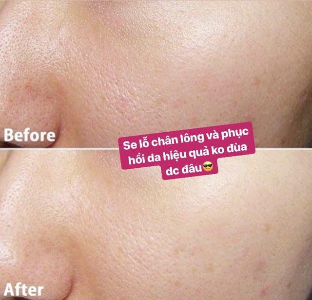 Toner ý dĩ Naturie Hatomugi Dưỡng Sáng Cân Bằng Da Skin Conditioner 500ml Nhật Bản | BigBuy360 - bigbuy360.vn