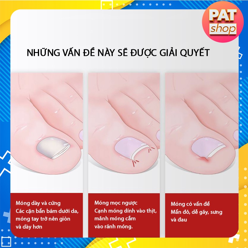 Kềm cắt móng, cắt da chết, kìm cắt móng mọc ngược Chuyên Nghiệp Bằng Thép Không Gỉ #4