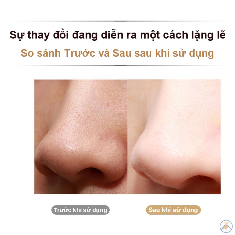 Máy cà da sủi da sóng siêu âm - Máy làm sạch sâu lỗ chân lông - Máy spa thu nhỏ lỗ chân lông