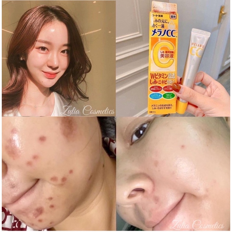 [FREE SHIP] Tinh Chất Serum Hỗ Trợ Giảm Thâm Cc Melano