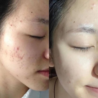Chấm Mụn Mario Badescu Drying Lotion