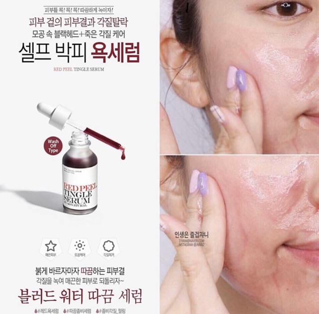 Gói dùng thử Sample Red Peel Tingle Serum mẫu mới