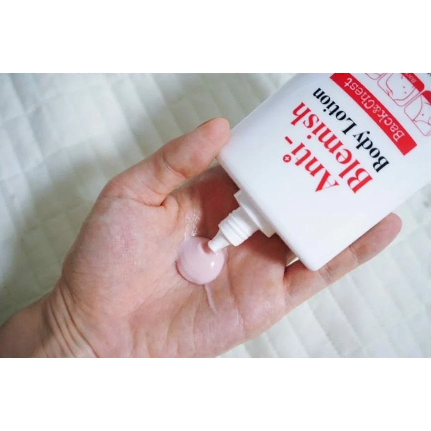 Sữa Dưỡng Thể Chăm Sóc Da Mụn, Mờ Thâm, Dưỡng Trắng Cho Cơ Thể Tiam Anti-Blemish | BigBuy360 - bigbuy360.vn