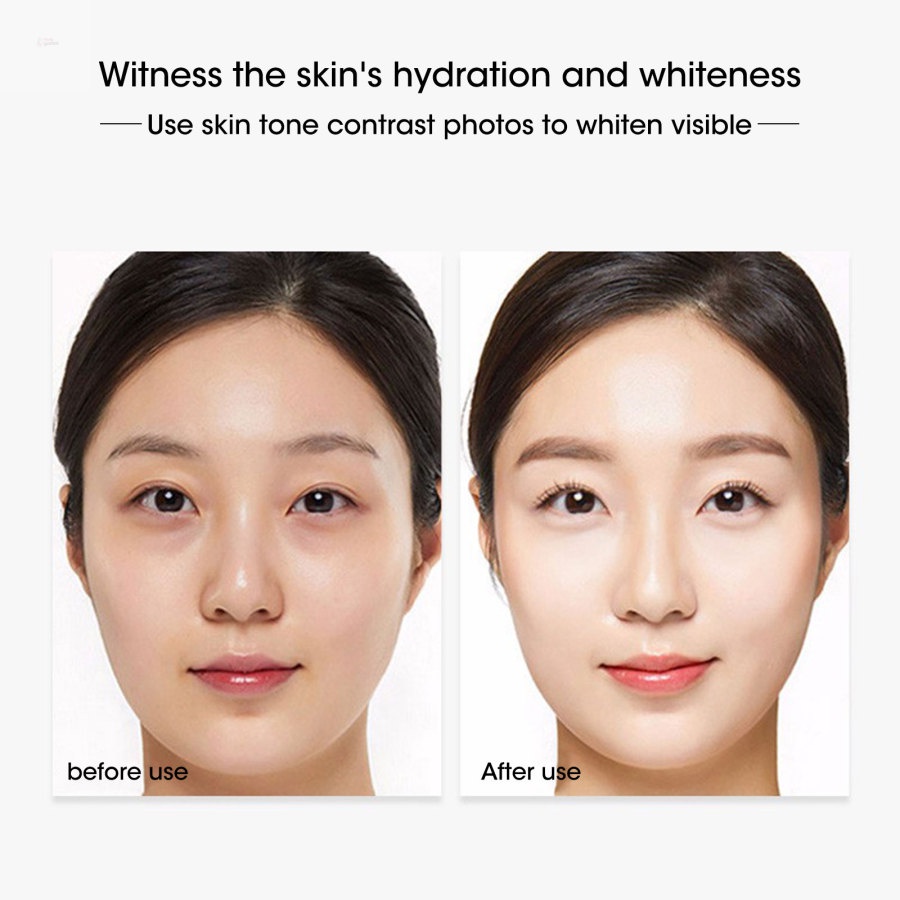 Kem hỗ trợ giảm tàn nhang 20g dưỡng ẩm làm trắng chăm sóc da