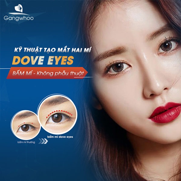 Dịch vụ Bấm mĩ Dove Eye tại Gangwhoo