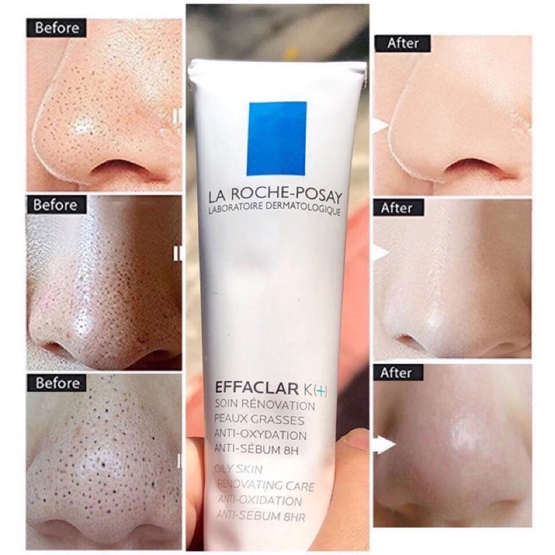 Kem Dưỡng La Roche-Posay Giảm Mụn Đầu Đen &amp; Bóng Nhờn 40ml