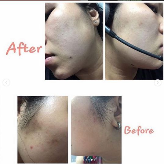 Kem thâm handmade Sunday Beauty