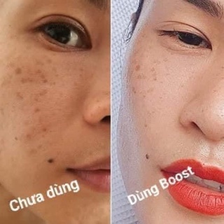 | NUSKIN | Máy Đẩy Tinh Chất AGELOC BOOST