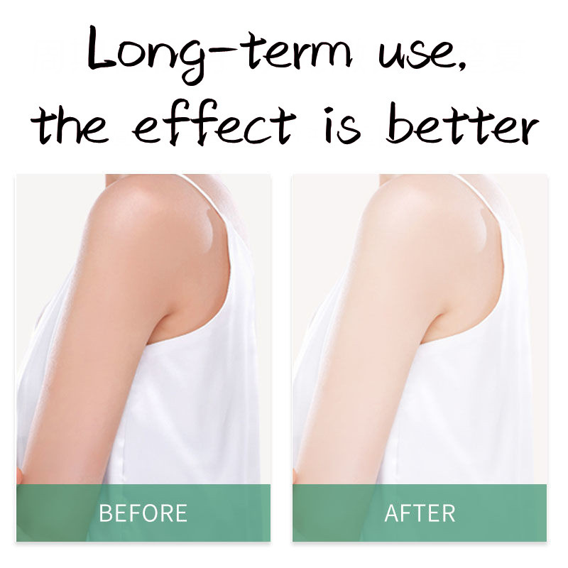 Mặt Nạ Niacinamide Giúp Dưỡng Ẩm Làm Trắng Và Chăm Sóc Da Tay