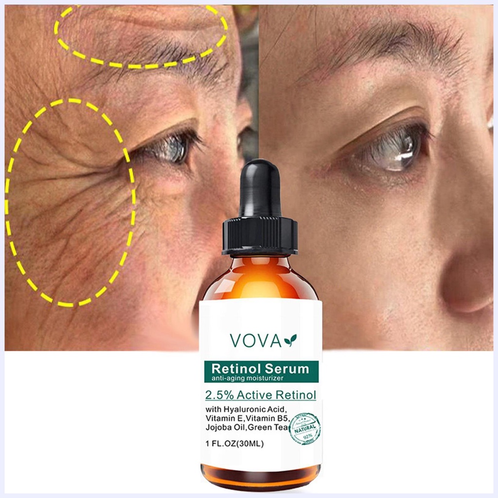 Serum Retinol 2.5 Retinol Chống Lão Hóa Se Khít Lỗ Chân Lông Làm Mờ Vết Thâm Làm Sáng Da