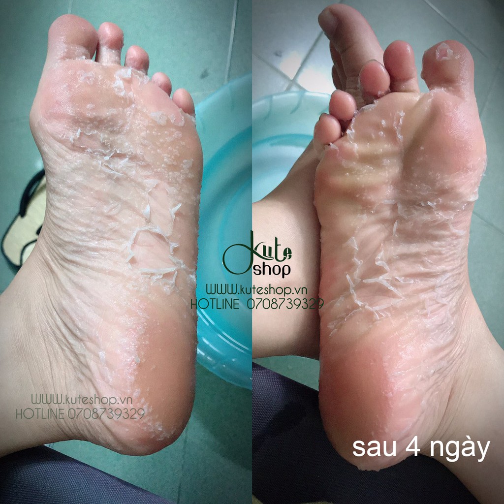 Túi ủ làm bong da chết bàn chân hàng nội địa Nhật (Mino Baby Foot) | BigBuy360 - bigbuy360.vn