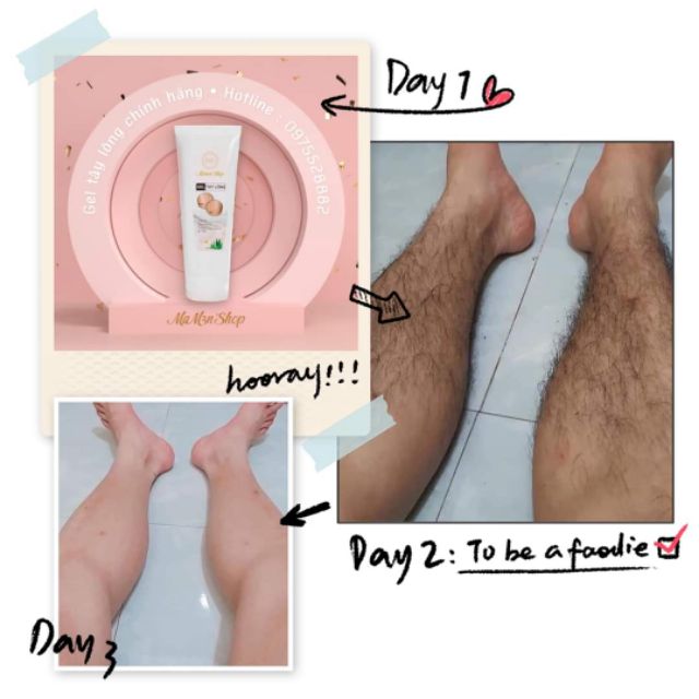 Kem triệt lông râu tận gốc vĩnh viễn thảo dược