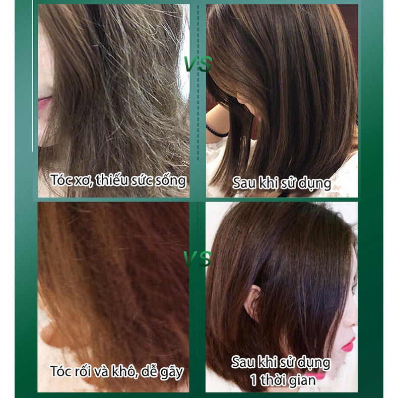 Tẩy da chết da đầu NORO kiểm soát dầu nhờn giảm gầu bết tóc cao cấp MOCCO nôi địa trung HXVS011