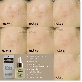 Serum TRI MUN BỌC  DOCTOR CARE