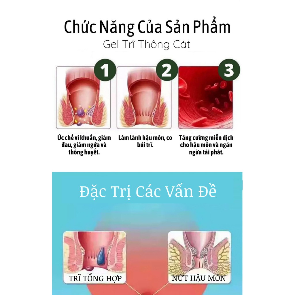 Trĩ Đông y gia truyền Thông Cát (Since1918)- Làn gió mới cho người bệnh trĩ, giảm co búi trĩ trong vòng 1 tháng | BigBuy360 - bigbuy360.vn
