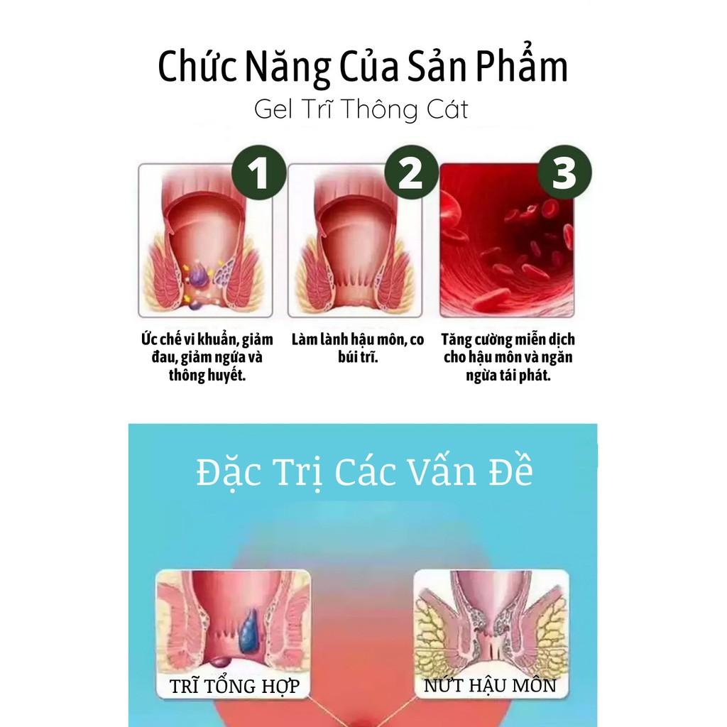 Trĩ Đông y gia truyền Thông Cát (Since1918)- Làn gió mới cho người bệnh trĩ, giảm co búi trĩ trong vòng 1 tháng