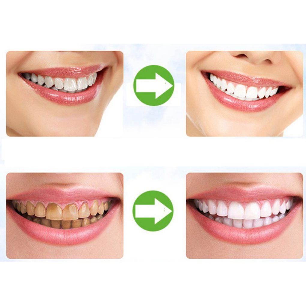 Bộ Kem Đánh Răng Than Tre Làm Trắng Công Thức Mạnh Mẽ