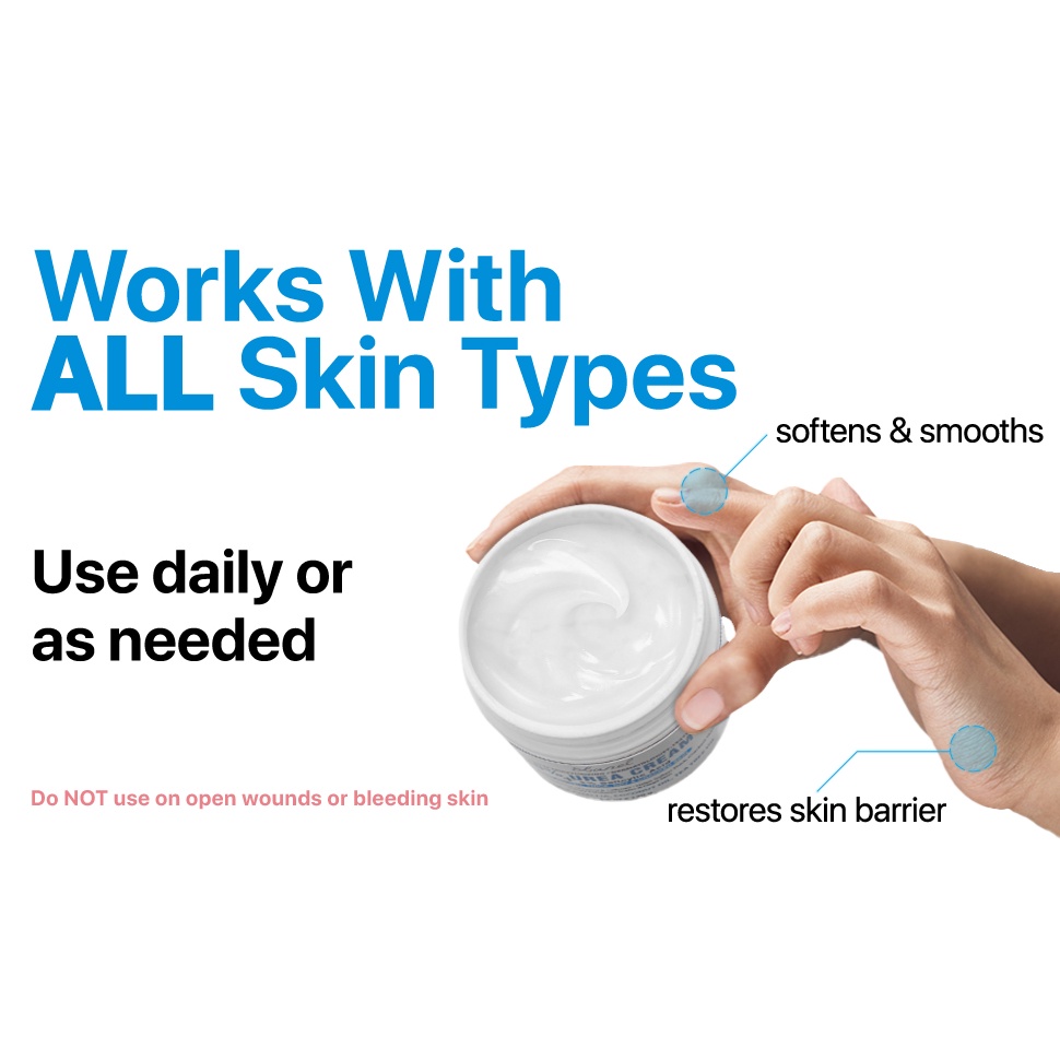 Ebanel Urea Cream 40% Plus Salicylic Acid 130g - Kem dưỡng ẩm chuyên sâu, làm mềm, phục hồi da khô, nám, sẹo, rỗ