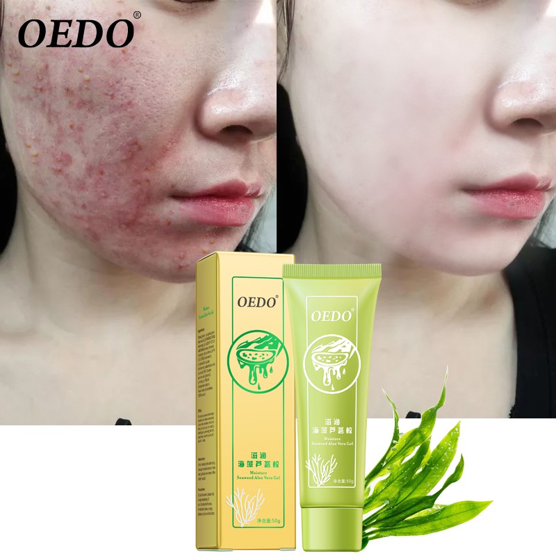 Bộ gel lô hội rong biển hydrat hóa làm trắng sáng da chống nếp nhăn lão hóa cải thiện da khô OEDO