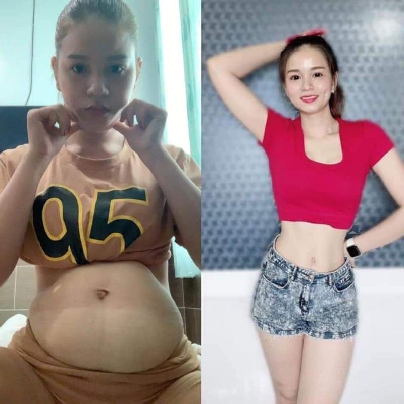 Tan mỡ Quế Olic - Xoa là giảm, đánh bay mỡ chỉ với 1 liệu trình