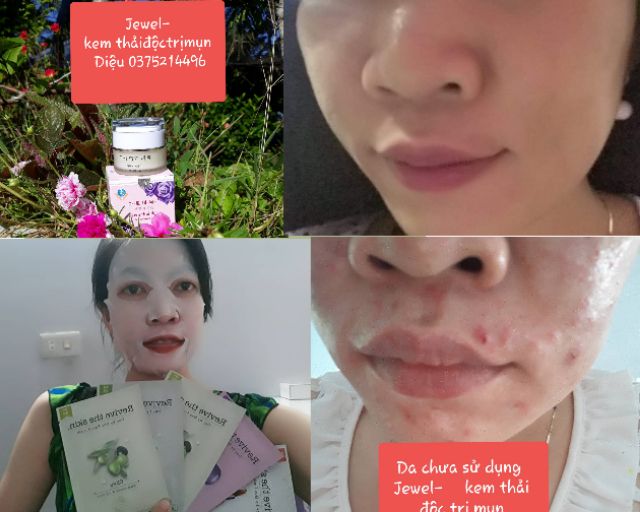 MẶT NẠ HÀN QUỐC -REVIVE THE SKIN - Mặt nạ  Trái olive labute revive the skin. Mặt nạ cho da nhạy cảm, da bị mụn.