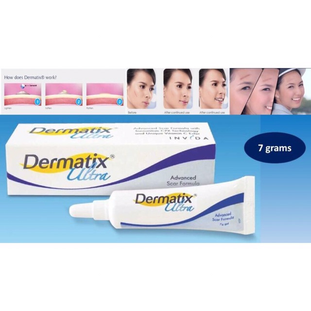 (Hàng Công Ty) Gel trị sẹo Dermatix Ultra