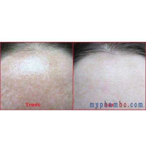 Serum Collagen tươi Teana C1 xách tay nga