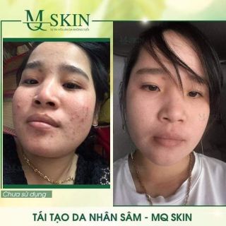Serum Sâm hoàn hảo