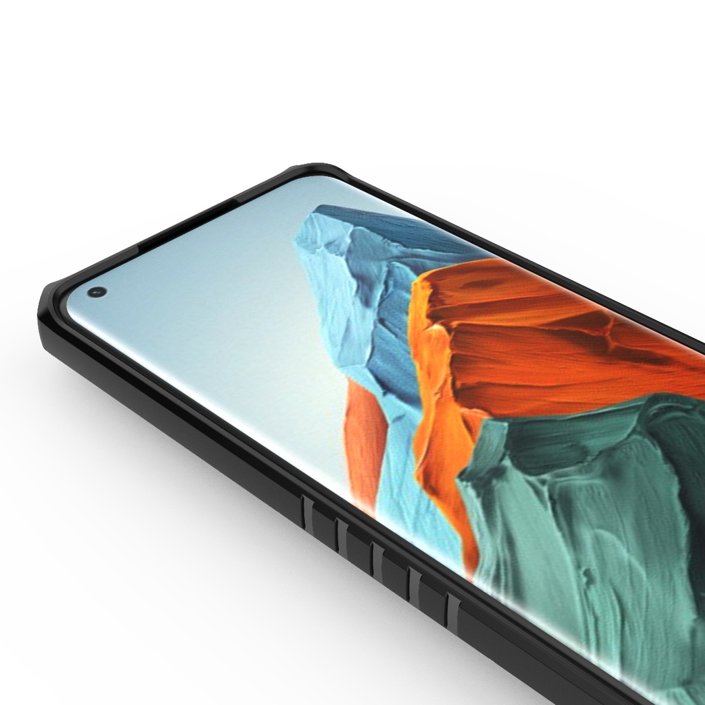 ỐP XIAOMI MI 11 PRO TỔ ONG IRING NHẪN GIÁ ĐỠ XEM PHIM THỜI TRANG CAO CẤP
