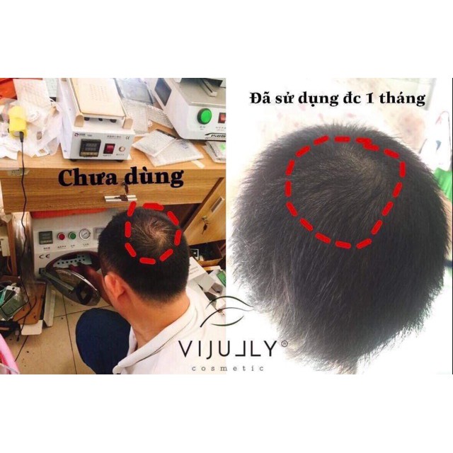 Tinh Dầu Bưởi Vi Jully không vỏ 100% Thiên Nhiên KÍCH MỌC TÓC-TRỊ RỤNG TÓC-GIÚP TÓC NHANH DÀI, DÀY | BigBuy360 - bigbuy360.vn