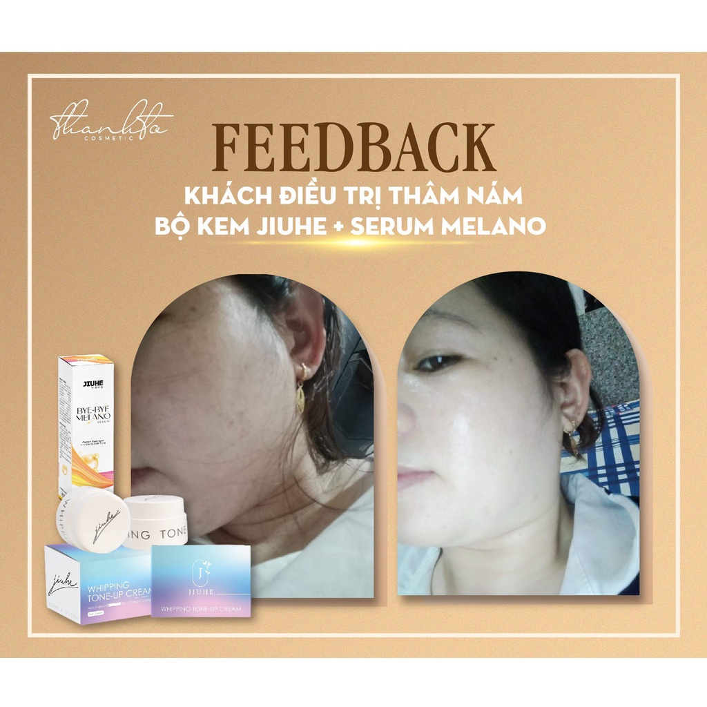 Serum Jiuhe Thâm Bye Bye Melano - Kem Face Jiuhe Thanh Tô - Tinh Chất Dưỡng Serum Jiuhe Mụn Acne Extra