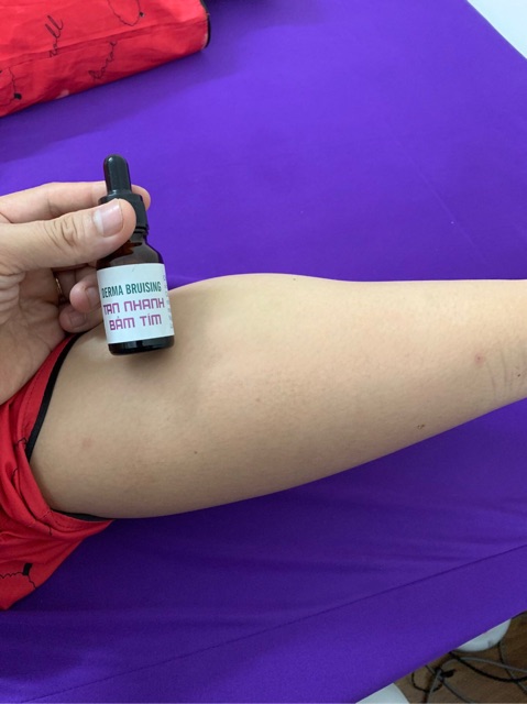 Gel bôi tan nhanh bầm tím - giảm sưng nề do chấn thương-sau thẩm mỹ DERMA BRUISING