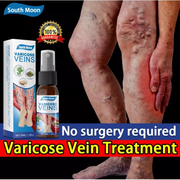 Xịt Hỗ Trợ Giảm Giãn Tĩnh Mạch Chống Giãn Tĩnh Mạch Hiệu Quả 30ml