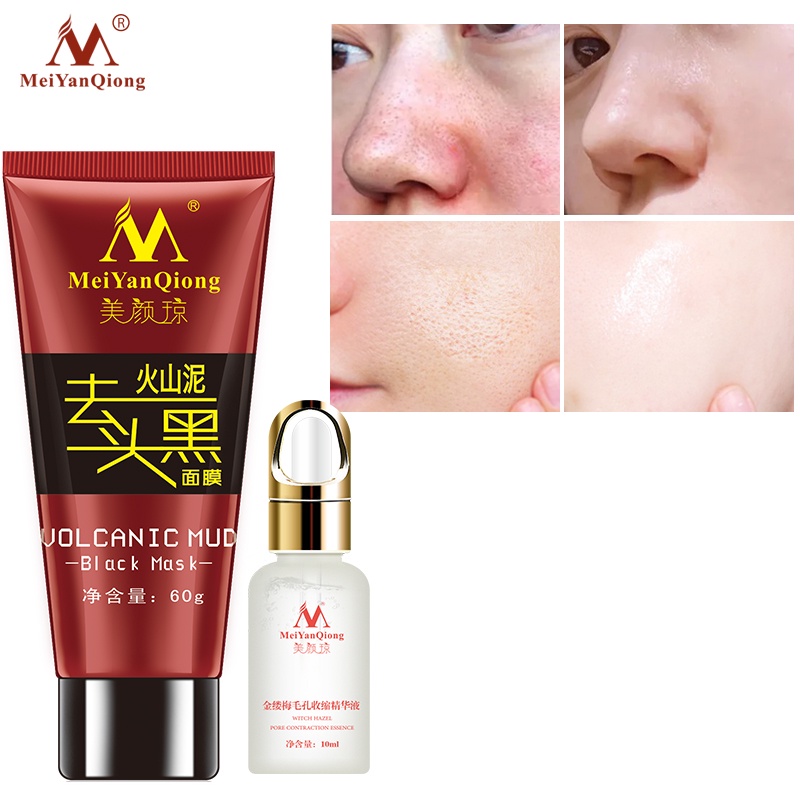 Bộ Mỹ Phẩm Chăm Sóc Da MeiYanQiong Gồm Mặt Nạ Bùn Núi Lửa Và Serum Se Khít Lỗ Chân Lông Giúp Tẩy Mụn Đầu Đen