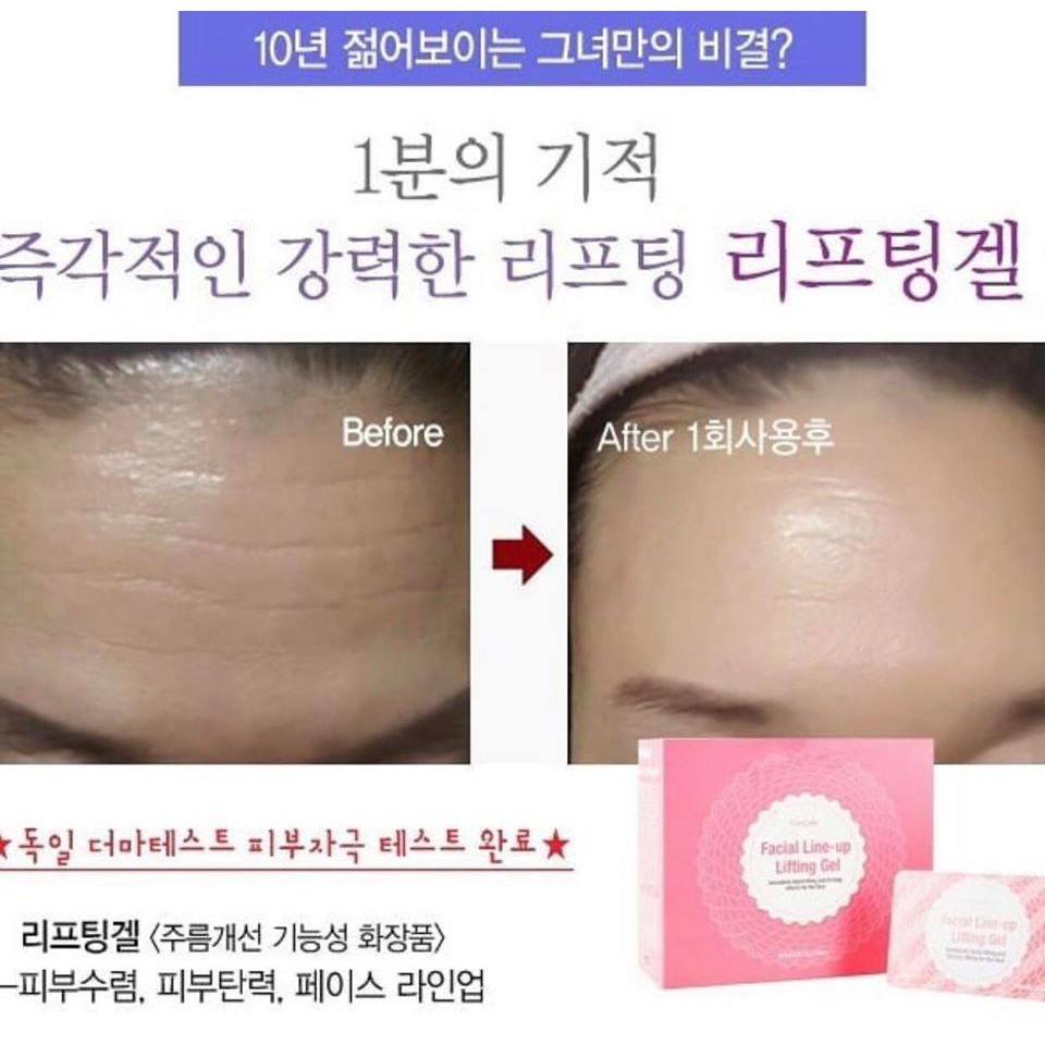 Gel Nâng Cơ Mặt cải thiện nếp nhăn, trẻ hóa da CareCella Facial Line-up Lifting_Sunnycosmetic