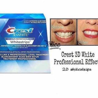 MIẾNG DÁN TRẮNG RĂNG CREST 3D WHITE PROFESSIONAL EFFECTS