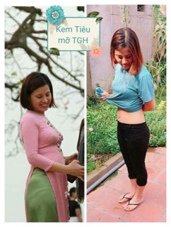 Kem tiêu mỡ trương gia hân