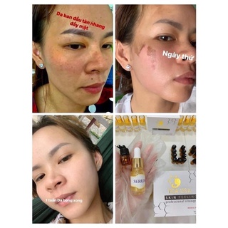 BỘ MỸ PHẨM THAY DA TCA USA 50ML