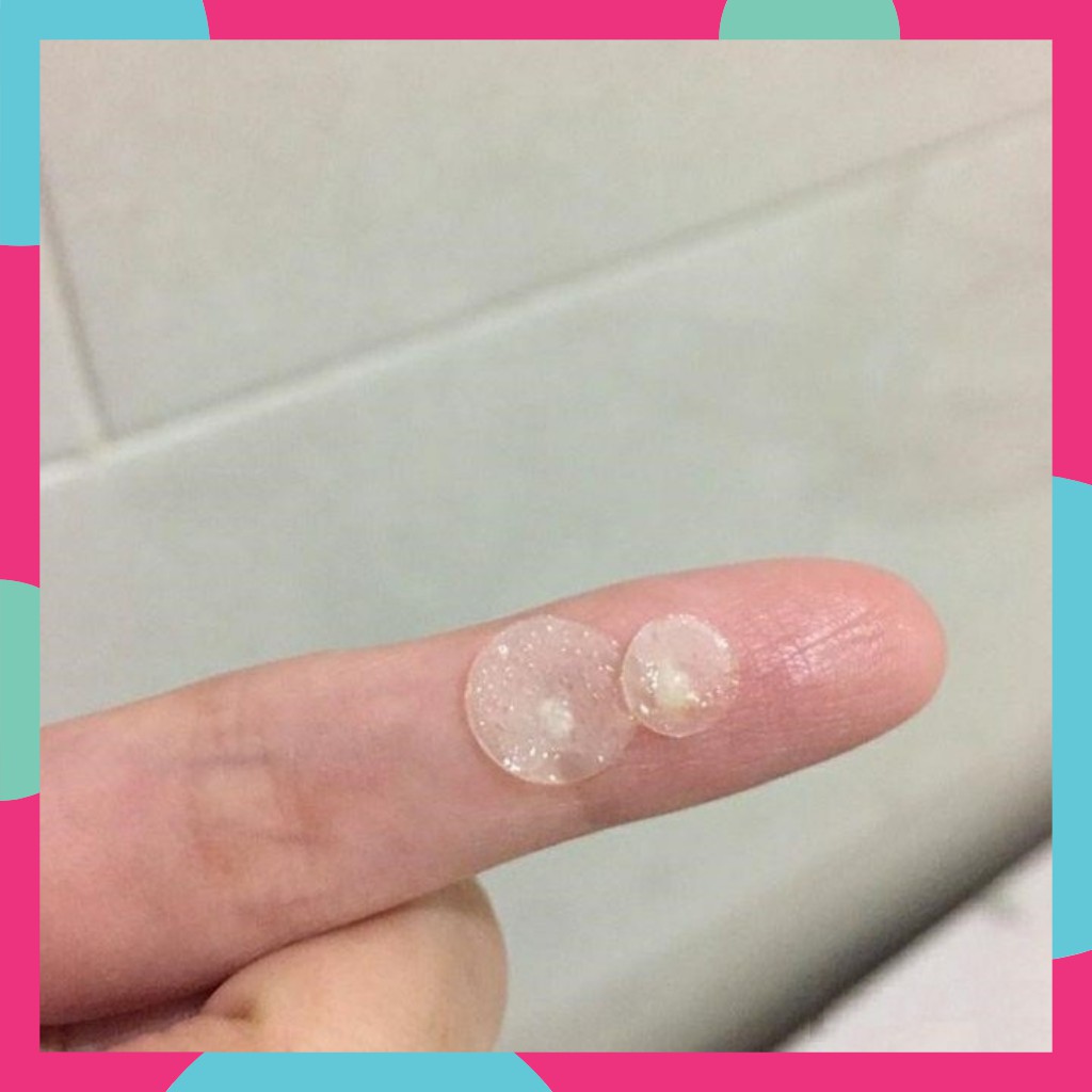 Miếng Dán Mụn  Acnes Clear Patch - Mụn Cóc - mụn đầu đen - chăm sóc da - da nhạy cảm - nền - mỹ phẩm - mỹ phẩm - ĐYVĐ! | BigBuy360 - bigbuy360.vn